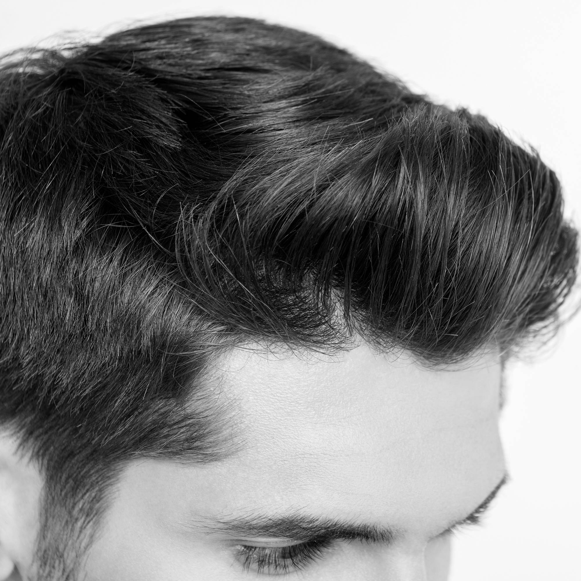 Shampoo for Extreme Dandruff